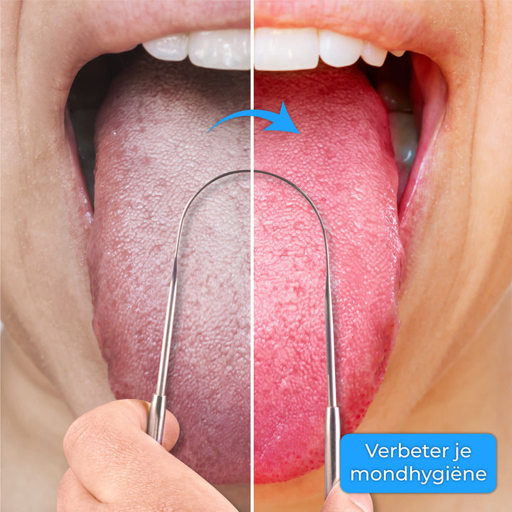 Tongschraper - 3 delig