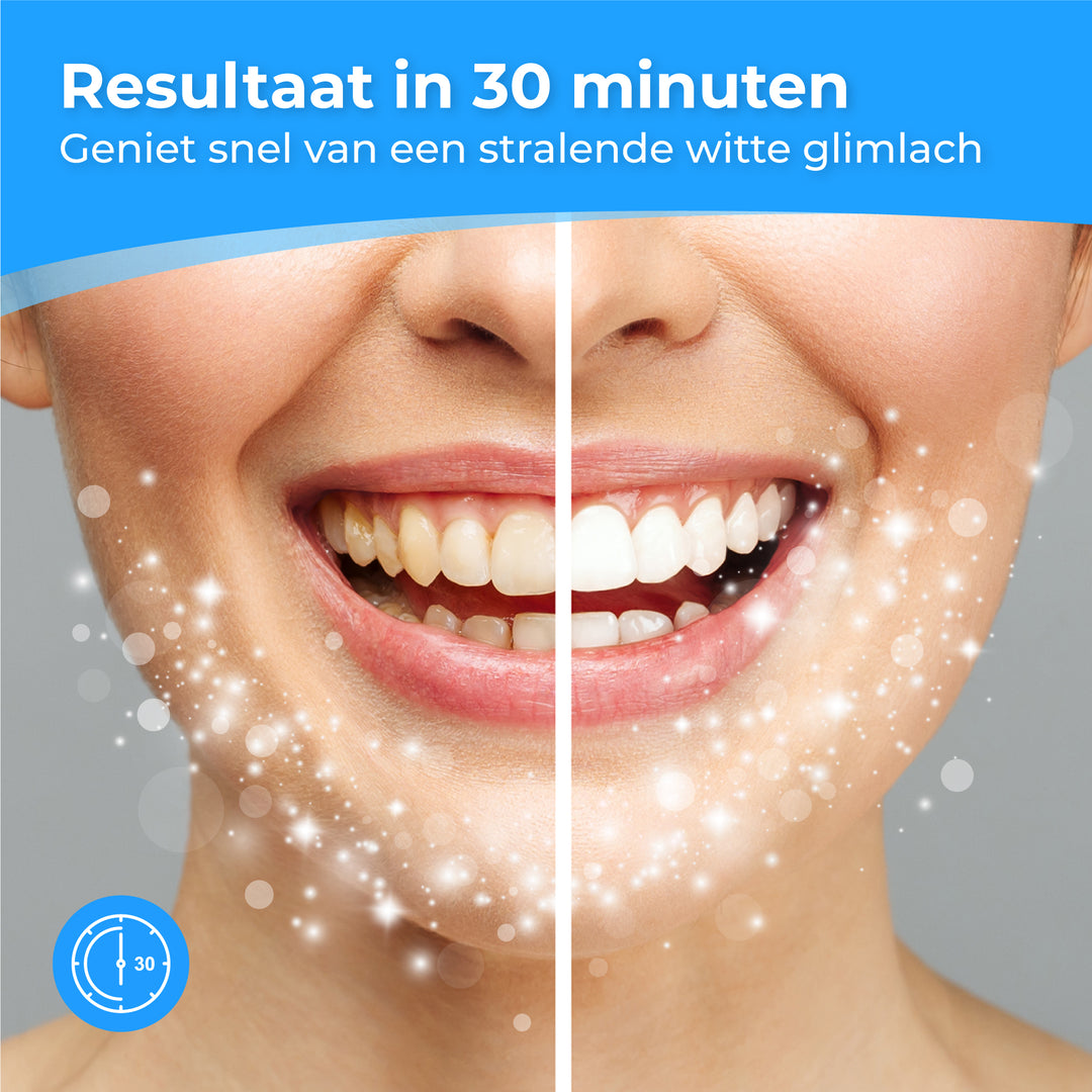 Teeth Whitening Strips - 14 Stuks