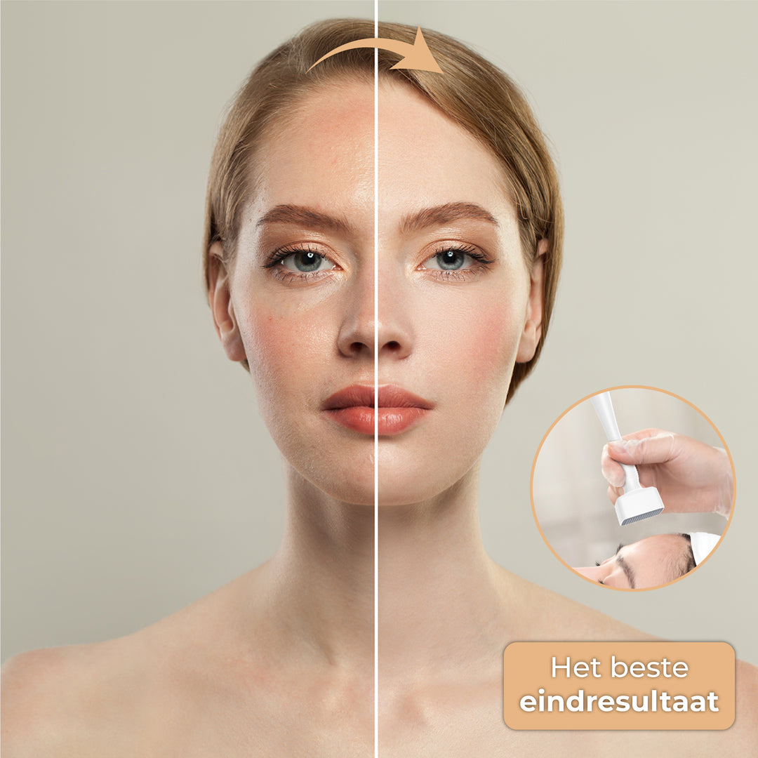 Dermastamp - Verstelbaar