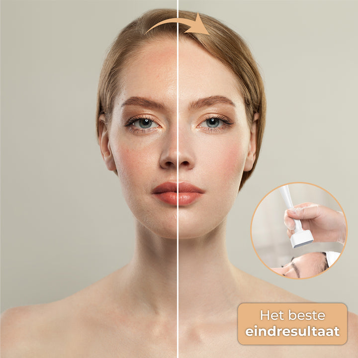 Dermastamp - Verstelbaar