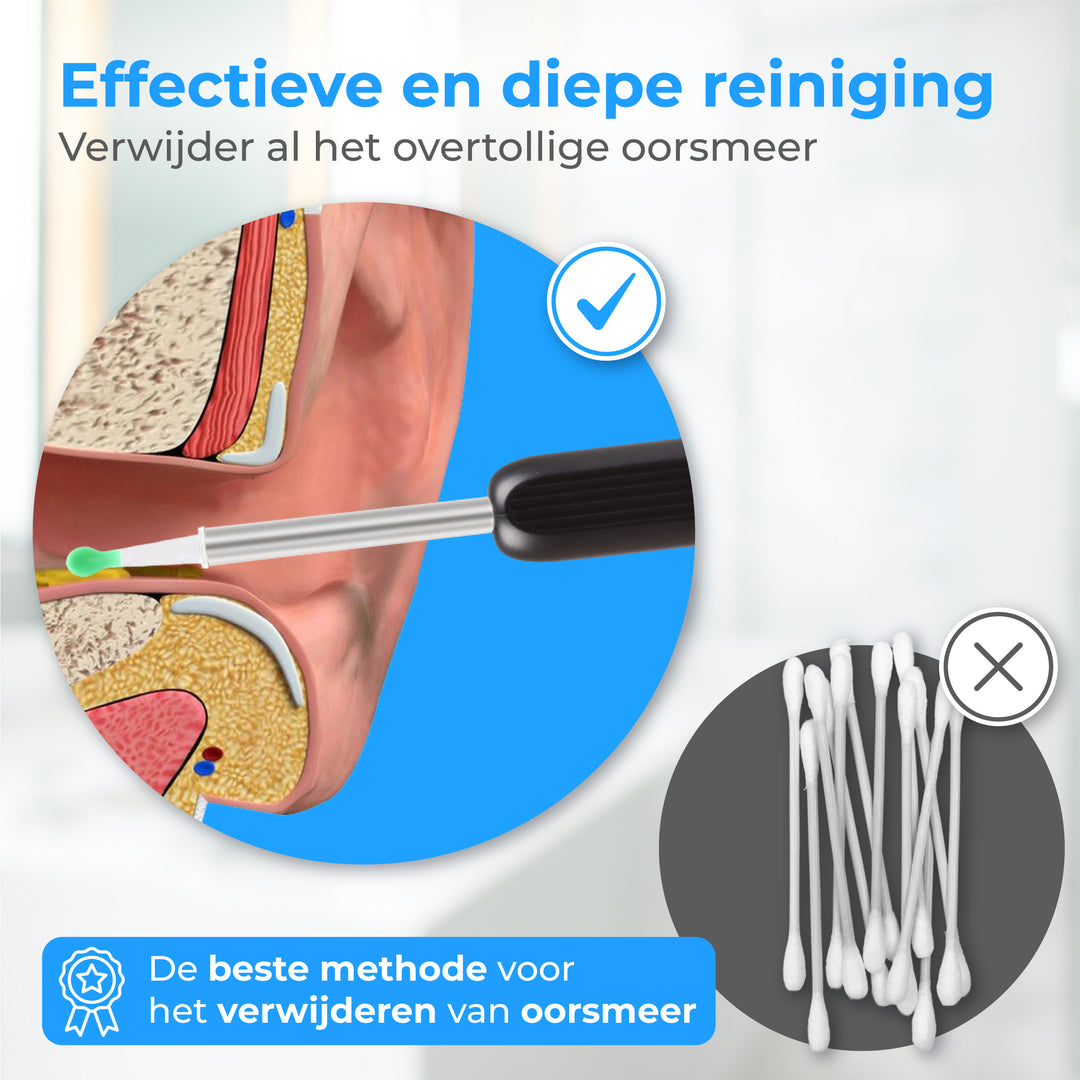 Oorsmeer Verwijderaar met Camera App