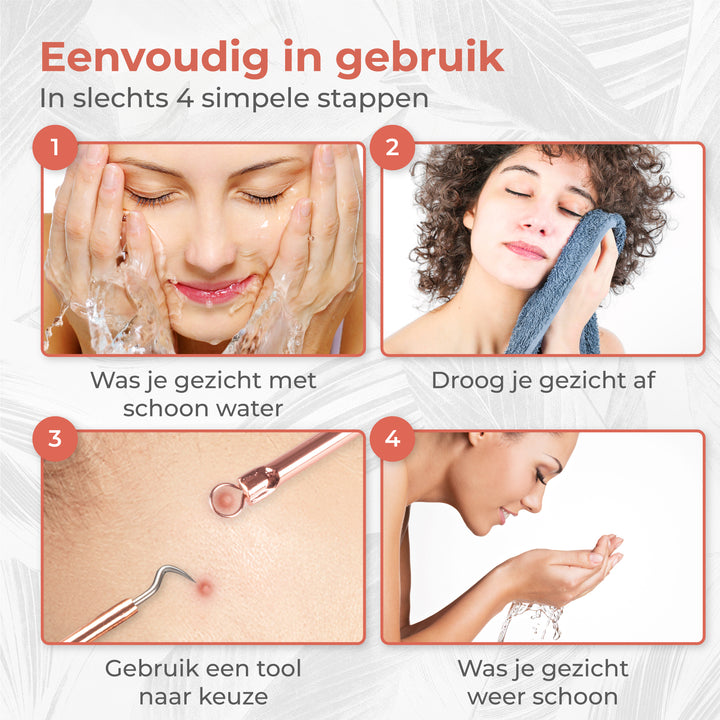 Blackhead Remover Set - Rose Goud