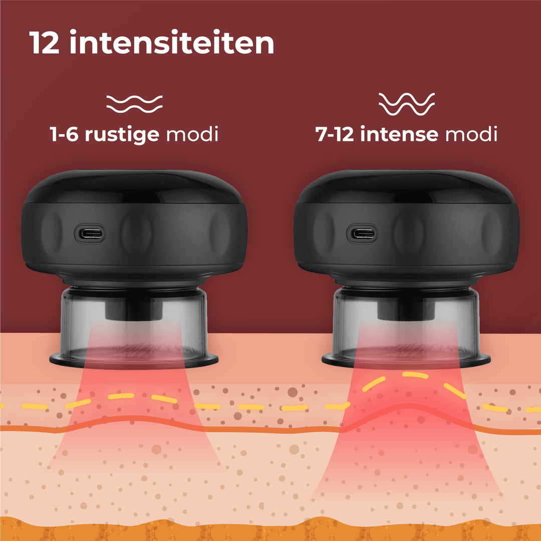 Elektrische Cupping Cup - Zwart